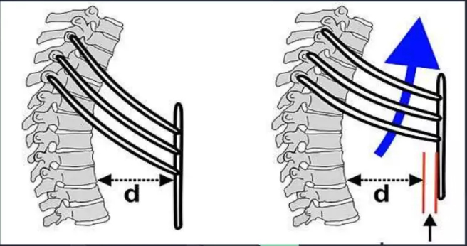 illustration of ribs moving in the pump handle. Arrow shows the distance between sternum and ribs and how that distance changes and increases with inhalation much like the action of pumping a handle.